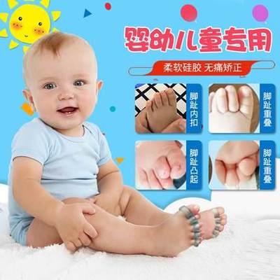 婴儿童脚趾头小孩大拇指外翻矫正器宝宝重叠分离器分趾大母指内扣