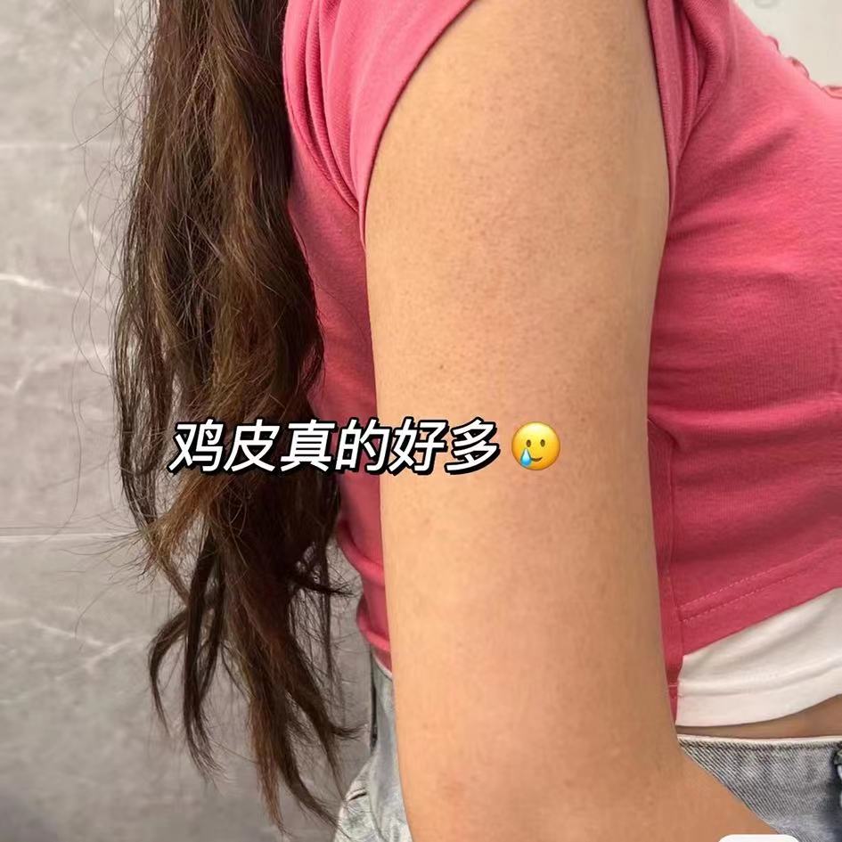 去鸡皮肤老牌子去死皮红点疙瘩鱼鳞周角化嫩白清洁角质全身皂