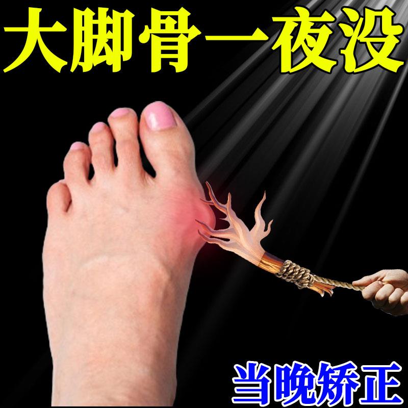 【100年大脚骨一夜直】拇指外翻膏贴拇外翻肌贴大脚骨脚趾矫正器