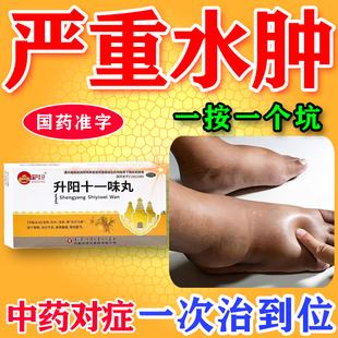 升阳十一味丸水肿消肿特用效药治老人全身浮肿脚肿手肿专用药中药
