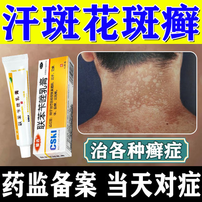 【锄选】联苯苄唑乳膏1%*15g*1支/盒