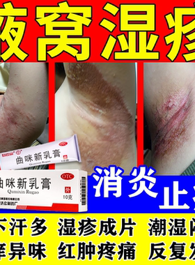 治腋下湿疹发痒腋窝淹红肿痛毛囊炎出汗多红疹瘙痒止痒曲咪新乳膏