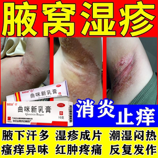 治腋下湿疹发痒腋窝淹红肿痛毛囊炎出汗多红疹瘙痒止痒曲咪新乳膏