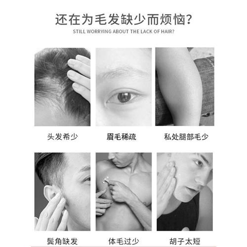 胡须生长液长胡子神器胡子增密络腮胡毛发胸毛发际线眉毛增长液