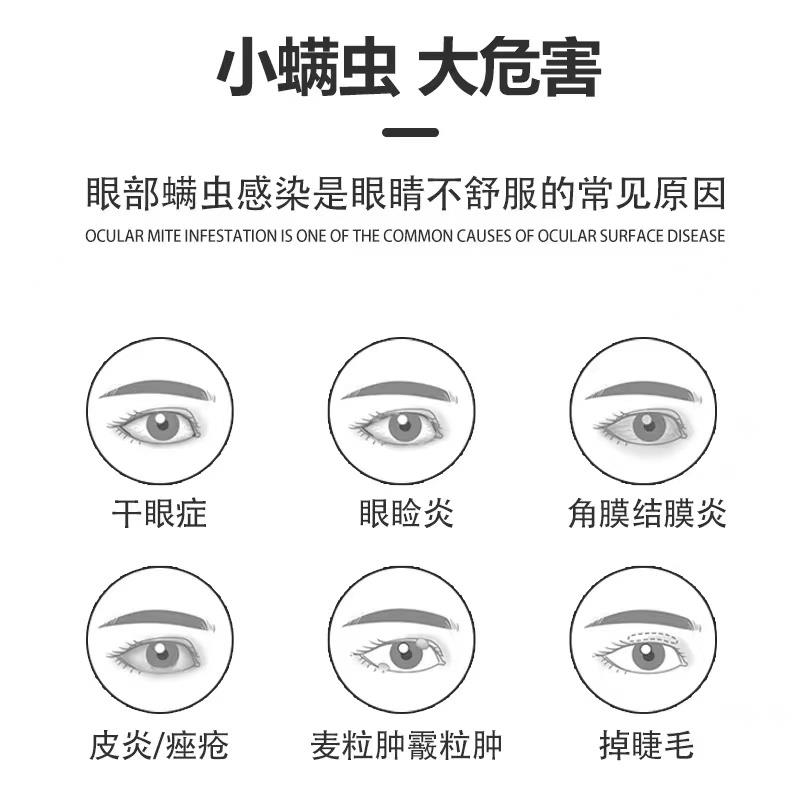 眼睛痒除螨滴眼液干涩发痒红血丝眼部清洁修正视疲劳非湿巾眼贴
