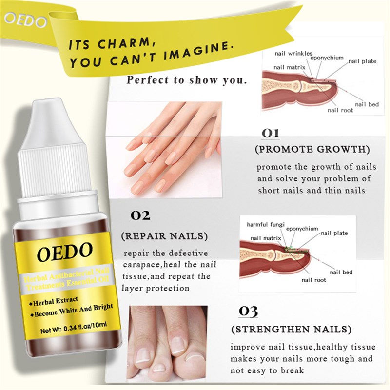 OFungal Nail Repair Essence Herbal Anti Fungus Treatment Ony