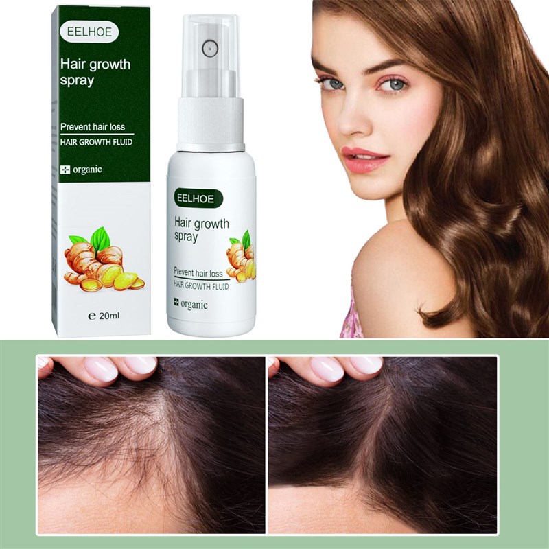Professional Ginger Anti Hair Loss Hair Growth Spray