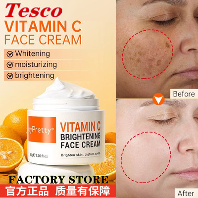Face Cream Vitamin C Remove Dark Spots Whitening Skin Care