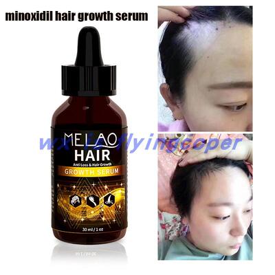 Hair Growth Essential Oil yrestorer Prevent loss Repair头发