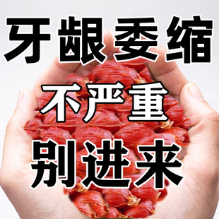 冶牙松【102%固齿】牙齿晃动牙龈委缩牙根外露牙龈肿痛专用牙膏JL