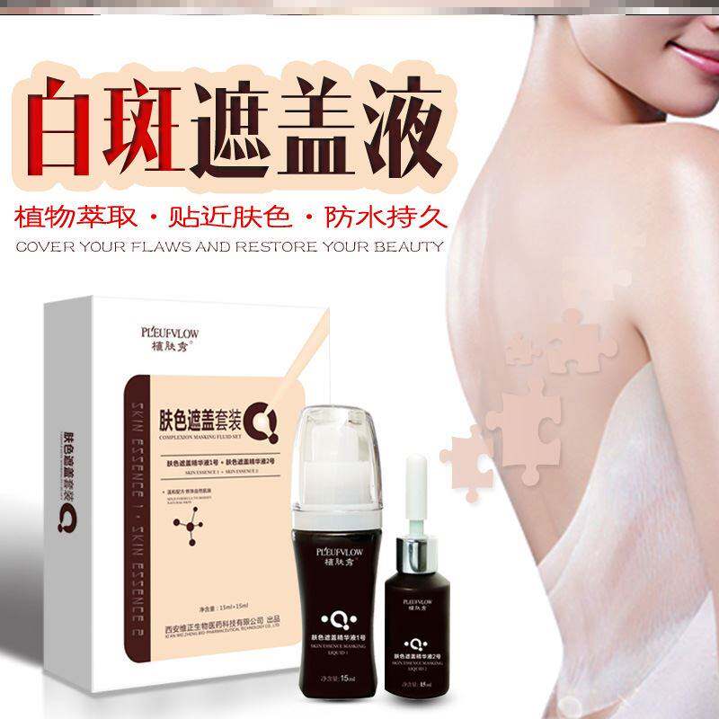 极速白癜风遮瑕薬膏快速消白斑专用外用黑色素生长遮盖家用