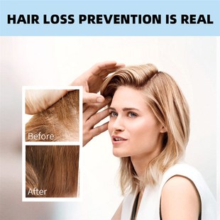 Spray Essential Men Growth Women for Essence Liquid Hair Oil