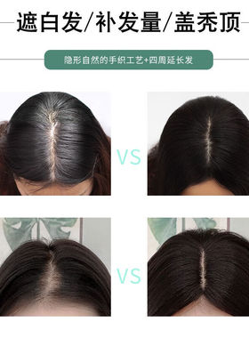 岚婷(LANTING)假发片女真发头顶补发片女中老年中长遮白发轻薄