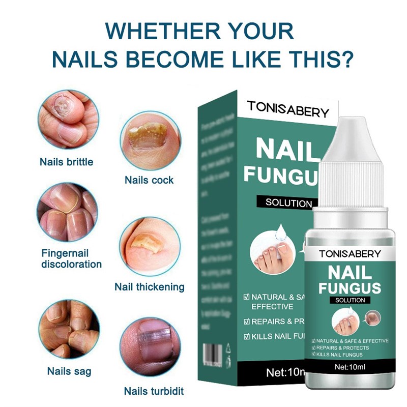 10ml Fungal Nail Repair Essence Serum Care Treatment Foot Na