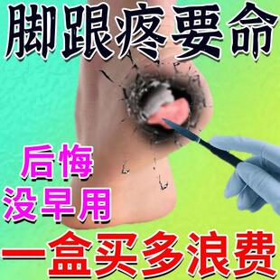 3天就好】脚底板疼足跟疼v痛跟腱焱脚底脚背韧带拉伤脚跟骨刺足跟