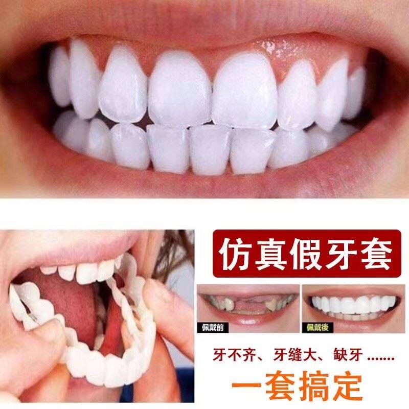 日本进口仿真牙套吃饭神器假牙套老人通用临时牙套缺牙遮丑防塞牙