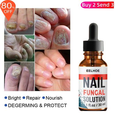 Foot Finger Liquid Anti Fungal Repair Serum Nail Removal Gel