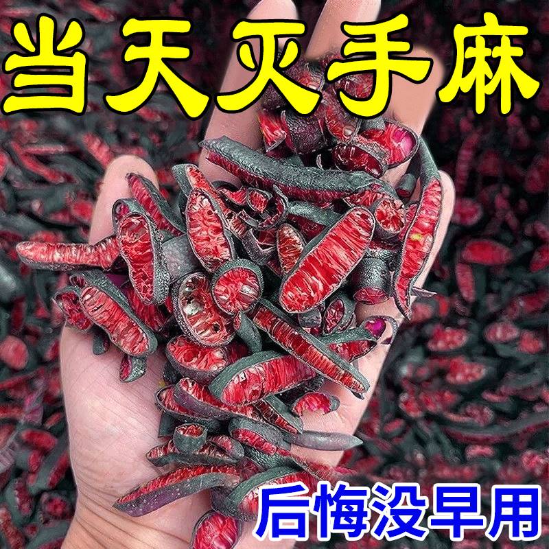 【麻木专用】手足麻木贴手脚麻木酸胀沉重指尖脚掌麻木刺痛麻贴X