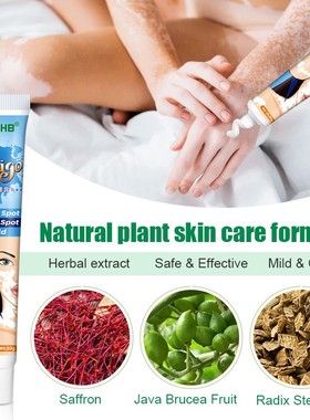 20g Herbal Extract Vitiligo Ointment Remove Ringworm White S