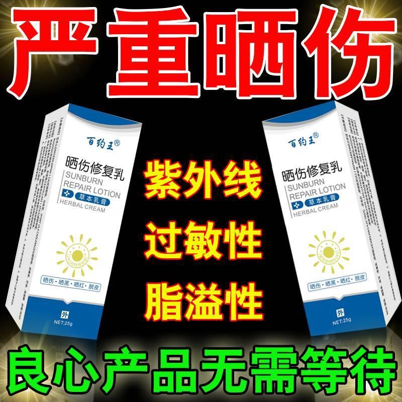 皮肤晒伤修复霜紫外线过敏日光性皮炎晒红脱皮红痒药修复滋润乳液