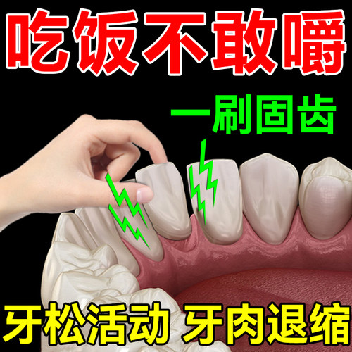 牙缝宽大【早用早舒服】牙齿松动牙龈萎缩肿痛牙根外漏固齿牙膏YN