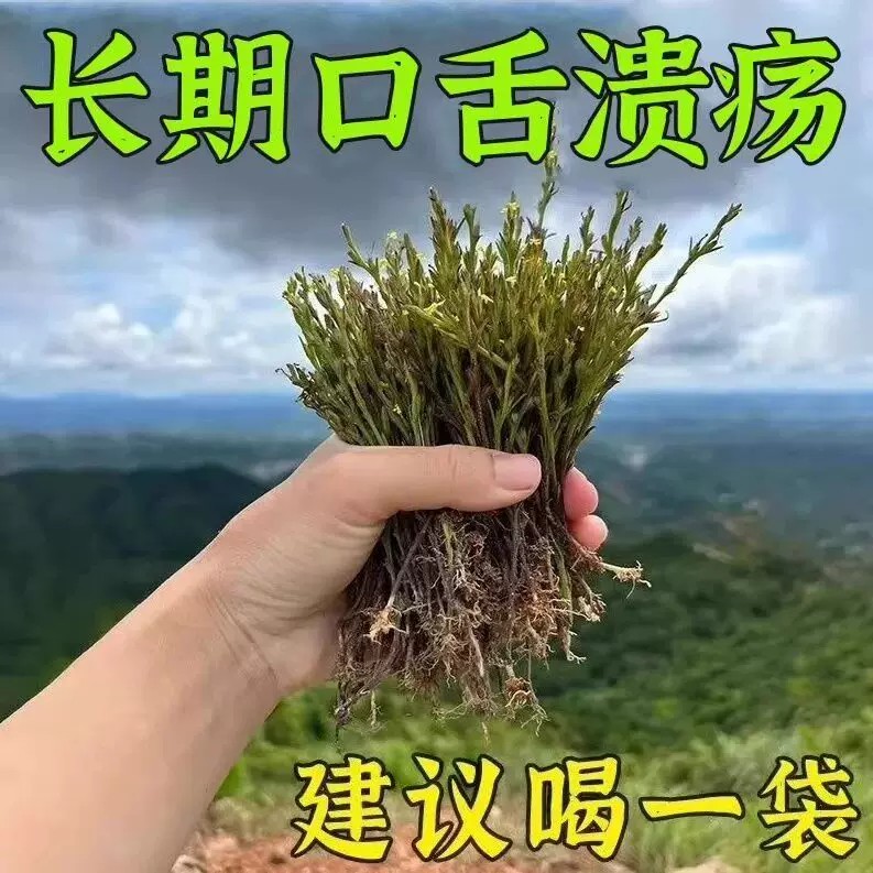 民间偏方口疮口舌生疮烂嘴起泡舌头生疮起泡烂嘴烂舌泻火