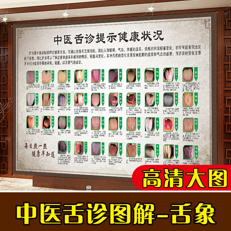 中医舌诊辩证图解挂图海报口腔舌头健康状况图谱贴画养生装饰画