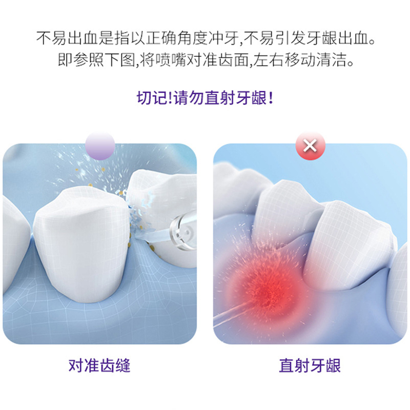 冲牙机家用洗牙器可携式水牙线电动牙齿清洗正畸专用洁牙牙缝清洁