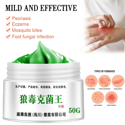 Psoriasis Dermatitis Eczema-like Eczema Ointment-Chinese Her