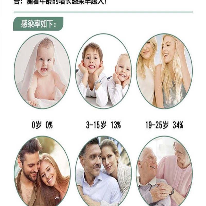 眼睛除螨洗眼液眼部专用叶黄素春季过敏眼睛痒干涩去X螨虫止痒清