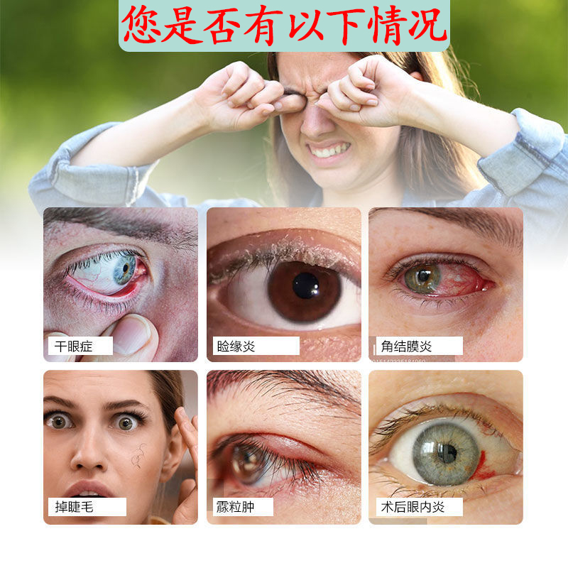 眼睛除螨虫洗眼液眼部清洁止痒专用叶黄素眼干涩发痒充血过敏驱螨