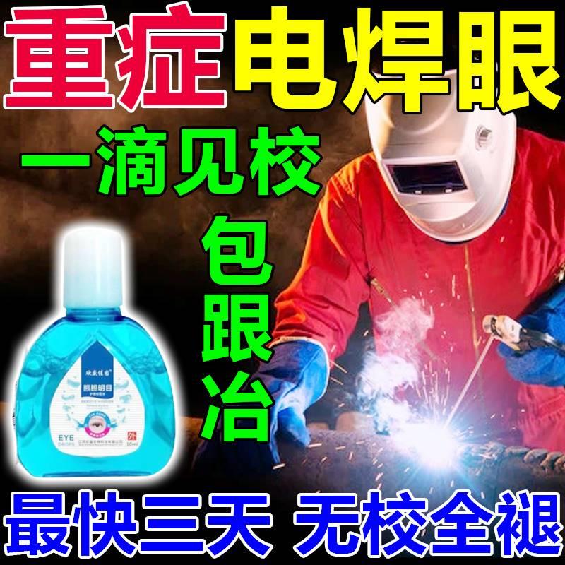 电焊眼水眼睛灼热流泪睁不开缓解焊工电焊眼焊王专用滴眼液