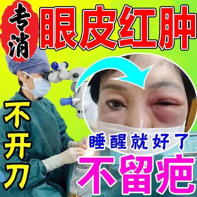眼皮红肿痒过敏性鼻炎眼睛痒乾涩发痒眼角痒缓解疲劳模糊滋润保湿