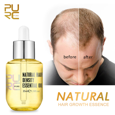 Natural Hair Growth Essence Thickener Regrowth Serum Treatme