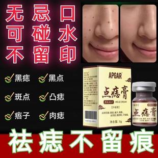 点痣膏无痕正品旗舰店去痣药水不留疤美容院专用无痛脸部去黑痦子