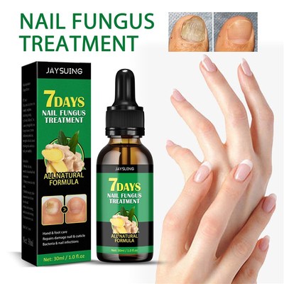 Ginger Nail Fungal Treatment Feet Essence Anti Infection