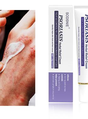 新品Psoriasis Eczema Herbal Cream Anti Fungal Desquamation T