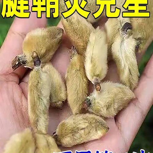 【腱鞘炎一晚除】拇指外翻腱鞘消除膏腱鞘贴矫正器扭伤手腕护腕JZ