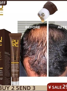 Natural Essence For Hair Growth Oil Scalp Massage Treatments