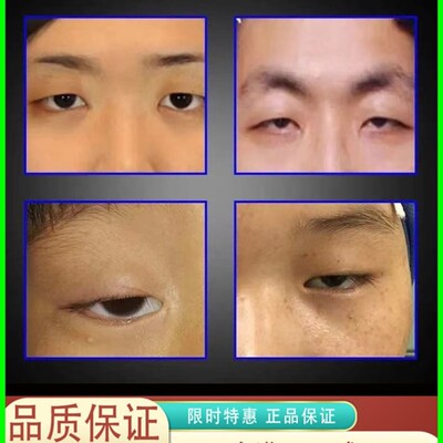 眼皮下垂a提拉贴防松弛上眼睑去肿定型老年人用提拉紧致双眼皮神