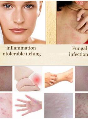 .Antibacterial Anti Fungus Bath Sulfur Soap Body Whitening S