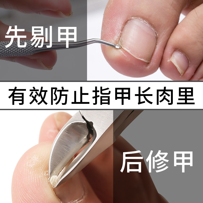 好货甲沟专用剔甲器炎勺修脚死皮神器脚趾甲缝嵌甲工具装不锈钢剃