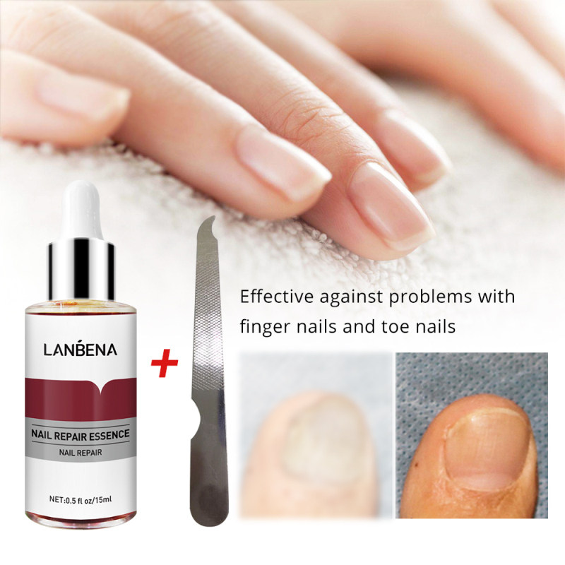 Lanbena repara??o de unhas essncia soro fngico tratame