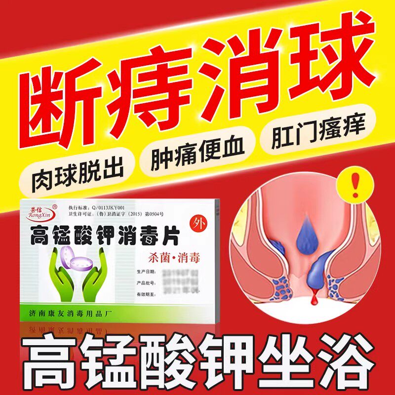 医用高锰酸钾片痔疮坐浴肛门瘙痒红肿效屁眼特止痒女性药大便出血