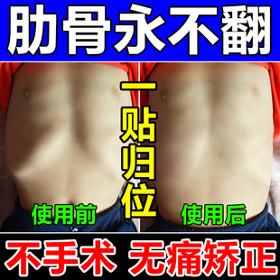 产後肋骨外翻矫正器男女儿童胸肋骨胸膜炎凸起神经性软骨疼痛药贴