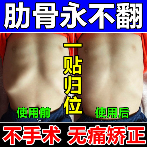 产後肋骨外翻矫正器男女儿童胸肋骨胸膜炎凸起神经性软骨疼痛药贴