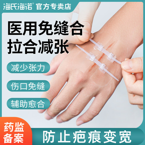 海氏海诺减张贴减张器医用