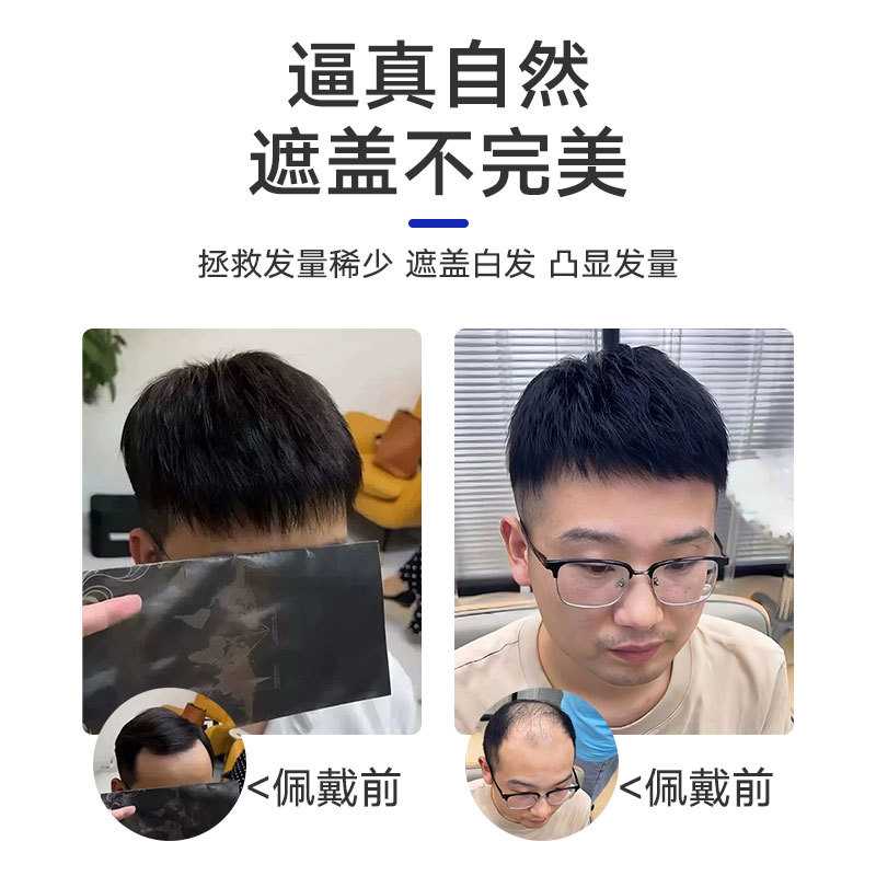 新款直销假发男短发全真发头顶无痕发片全手织韩版栗子头秃顶地中