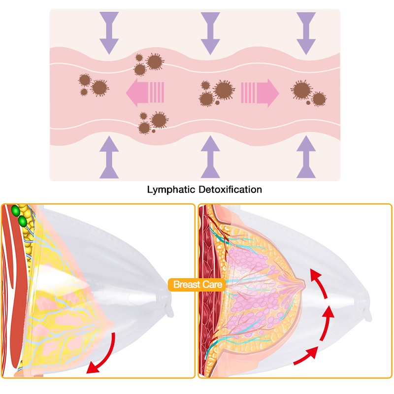 BBL Butt Lifting Colombien Machine 18cm Vacuum Mega Cup Mass