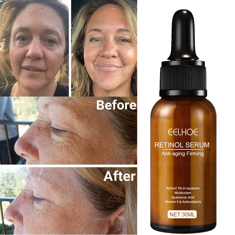 Retinol Anti Aging Removal Wrinkle Serum Firm Lift Fade Fine